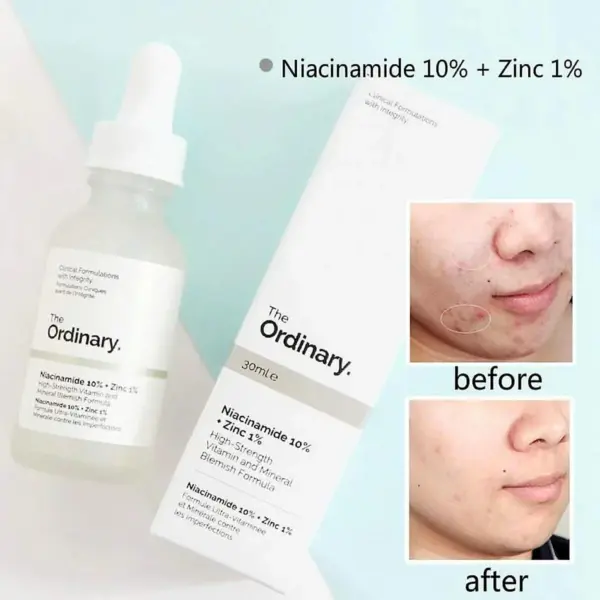 The Ordinary Niacinamide 10%+Zinc1% - Image 3